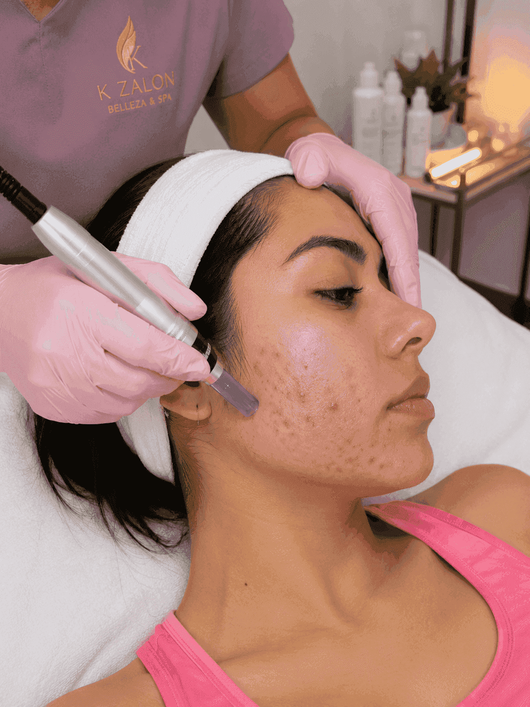 Limpieza Facial Profunda Acné Skin